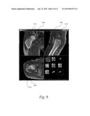 Anatomy Aware Articulated Registration for Image Segmentation diagram and image