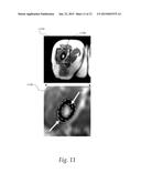 Anatomy Aware Articulated Registration for Image Segmentation diagram and image