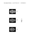 HEAD-POSE INVARIANT RECOGNITION OF FACIAL EXPRESSIONS diagram and image