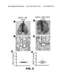 INDUCTION OF TOLERANCE IN LUNG ALLOGRAFT TRANSPLANTATION diagram and image