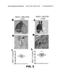 INDUCTION OF TOLERANCE IN LUNG ALLOGRAFT TRANSPLANTATION diagram and image