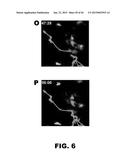 INDUCTION OF TOLERANCE IN LUNG ALLOGRAFT TRANSPLANTATION diagram and image