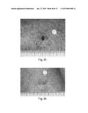 METHODS FOR TREATMENT OF ONCOLOGICAL DISORDERS USING AN EPIMETABOLIC     SHIFTER (COENZYME Q10) diagram and image