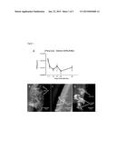 MULTIVALENT VACCINE PROTECTION FROM STAPHYLOCOCCUS AUREUS INFECTION diagram and image