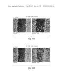 METHODS OF THERAPEUTIC TREATMENT OF EYES diagram and image