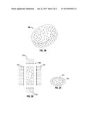 HYDROGEL IMPLANTS WITH VARYING DEGREES OF CROSSLINKING diagram and image