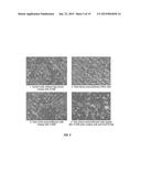 PROTECTION AGAINST AND TREATMENT OF IONIZING RADIATION diagram and image