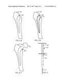 INJECTABLE HYDROGEL SYSTEM TO MODULATE HOST RESPONSE AT BONE IMPLANT     INTERFACE diagram and image