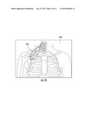 SYSTEMS, DEVICES, AND METHODS FOR SIMULATING FETAL DELIVERY diagram and image