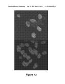 Method and System for Automated Image Analysis in Cancer Cells diagram and image