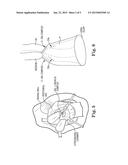 TRANSPERITONEAL PROLAPSE REPAIR SYSTEM AND METHOD diagram and image