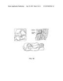 SPINAL CANAL ACCESS AND PROBE POSITIONING, DEVICES AND METHODS diagram and image