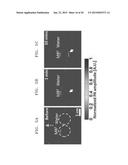 APPARATUS AND METHOD FOR COMBINED PHOTOACOUSTIC AND ULTRASOUND DIAGNOSIS diagram and image