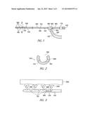 DIAGNOSTIC CATHETER USING A VACUUM FOR TISSUE POSITIONING diagram and image