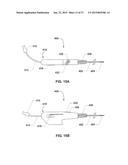 ENDOVENTRICULAR INJECTION CATHETER SYSTEM WITH INTEGRATED     ECHOCARDIOGRAPHIC CAPABILITIES diagram and image