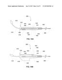 ENDOVENTRICULAR INJECTION CATHETER SYSTEM WITH INTEGRATED     ECHOCARDIOGRAPHIC CAPABILITIES diagram and image