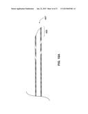 ENDOVENTRICULAR INJECTION CATHETER SYSTEM WITH INTEGRATED     ECHOCARDIOGRAPHIC CAPABILITIES diagram and image