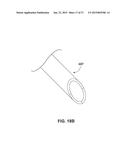 ENDOVENTRICULAR INJECTION CATHETER SYSTEM WITH INTEGRATED     ECHOCARDIOGRAPHIC CAPABILITIES diagram and image