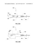 ENDOVENTRICULAR INJECTION CATHETER SYSTEM WITH INTEGRATED     ECHOCARDIOGRAPHIC CAPABILITIES diagram and image