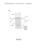 ULTRASOUND TREATMENT DEVICE AND METHODS OF USE diagram and image