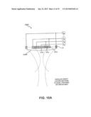 ULTRASOUND TREATMENT DEVICE AND METHODS OF USE diagram and image