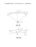 ULTRASOUND TREATMENT DEVICE AND METHODS OF USE diagram and image