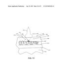 ULTRASOUND TREATMENT DEVICE AND METHODS OF USE diagram and image