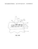 ULTRASOUND TREATMENT DEVICE AND METHODS OF USE diagram and image