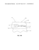 ULTRASOUND TREATMENT DEVICE AND METHODS OF USE diagram and image