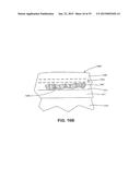 ULTRASOUND TREATMENT DEVICE AND METHODS OF USE diagram and image