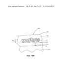 ULTRASOUND TREATMENT DEVICE AND METHODS OF USE diagram and image