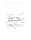 ULTRASOUND TREATMENT DEVICE AND METHODS OF USE diagram and image