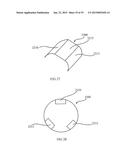 ULTRASOUND TREATMENT DEVICE AND METHODS OF USE diagram and image