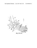 FOOT STABILIZER SOCKS AND STABILIZER PADS THEREFOR diagram and image