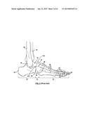 FOOT STABILIZER SOCKS AND STABILIZER PADS THEREFOR diagram and image