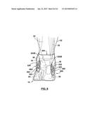 FOOT STABILIZER SOCKS AND STABILIZER PADS THEREFOR diagram and image