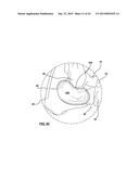 FOOT STABILIZER SOCKS AND STABILIZER PADS THEREFOR diagram and image