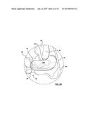 FOOT STABILIZER SOCKS AND STABILIZER PADS THEREFOR diagram and image