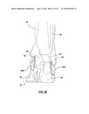 FOOT STABILIZER SOCKS AND STABILIZER PADS THEREFOR diagram and image