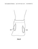 FOOT STABILIZER SOCKS AND STABILIZER PADS THEREFOR diagram and image