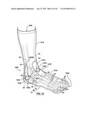 FOOT STABILIZER SOCKS AND STABILIZER PADS THEREFOR diagram and image