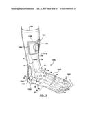 FOOT STABILIZER SOCKS AND STABILIZER PADS THEREFOR diagram and image