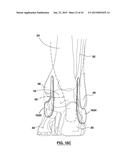 FOOT STABILIZER SOCKS AND STABILIZER PADS THEREFOR diagram and image