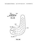 FOOT STABILIZER SOCKS AND STABILIZER PADS THEREFOR diagram and image