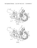 Occlusion Sensing for an Infusion Pump diagram and image