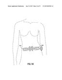 Wireless Communication for On-Body Medical Devices diagram and image