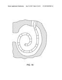 Implantable Fluid Delivery Apparatus and Implantable Electrode diagram and image