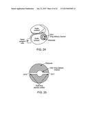 Implantable Fluid Delivery Apparatus and Implantable Electrode diagram and image