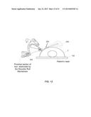 HYPERDEXTEROUS SURGICAL SYSTEM diagram and image