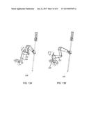 HYPERDEXTEROUS SURGICAL SYSTEM diagram and image